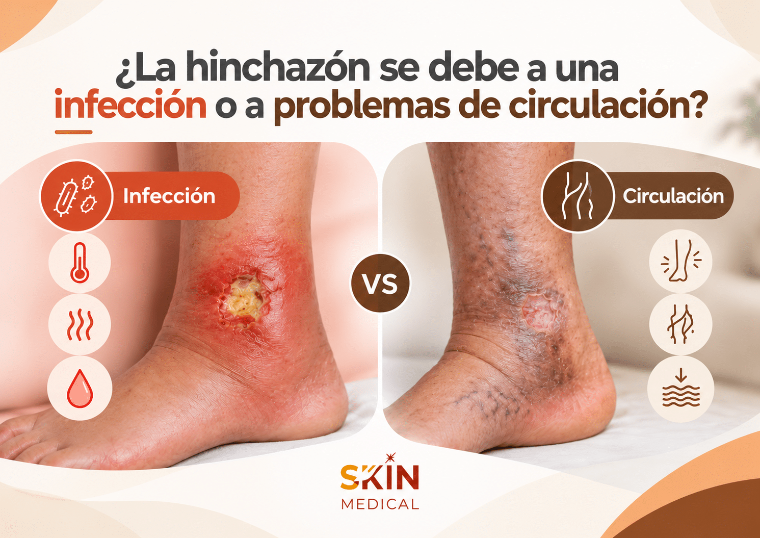 ¿La hinchazón se debe a una infección o a problemas de circulación?