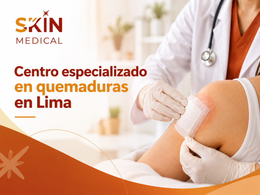 Centro especializado en quemaduras en Lima