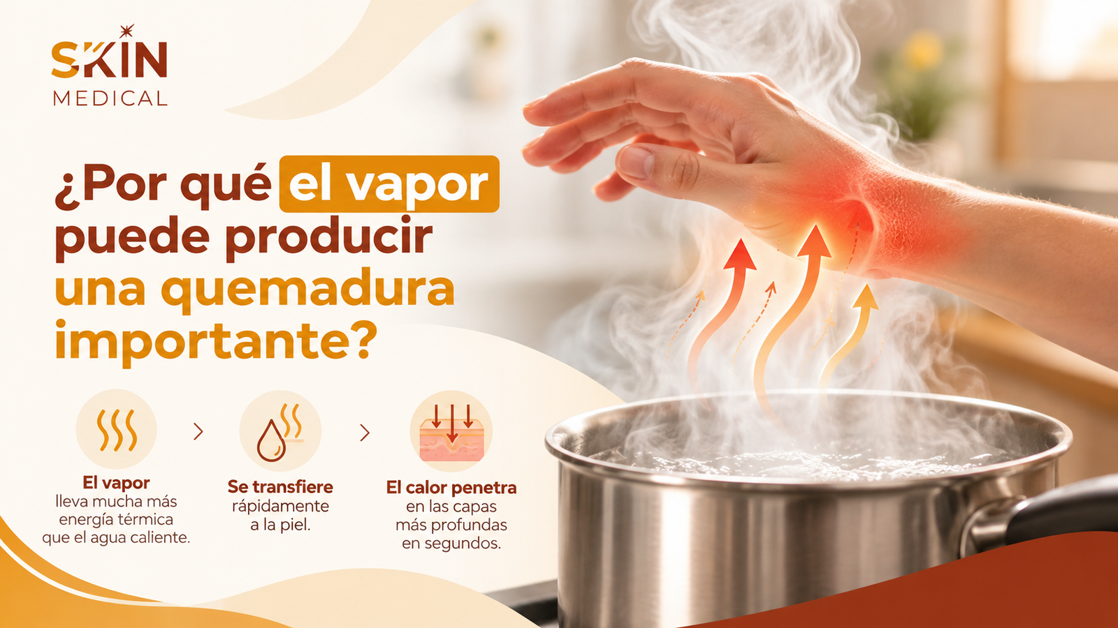 ¿Por qué el vapor puede producir una quemadura importante?