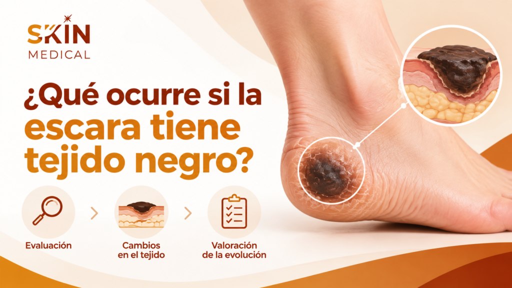 ¿Qué ocurre con la profundidad cuando una escara mejora?