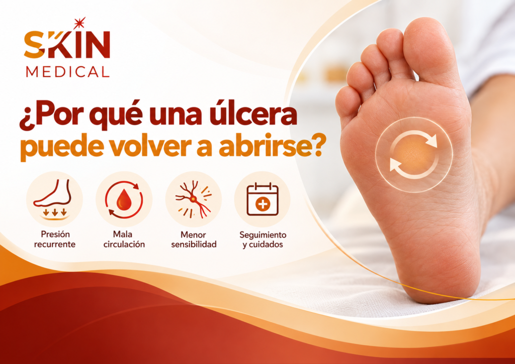 ¿Por qué una úlcera puede volver a abrirse?