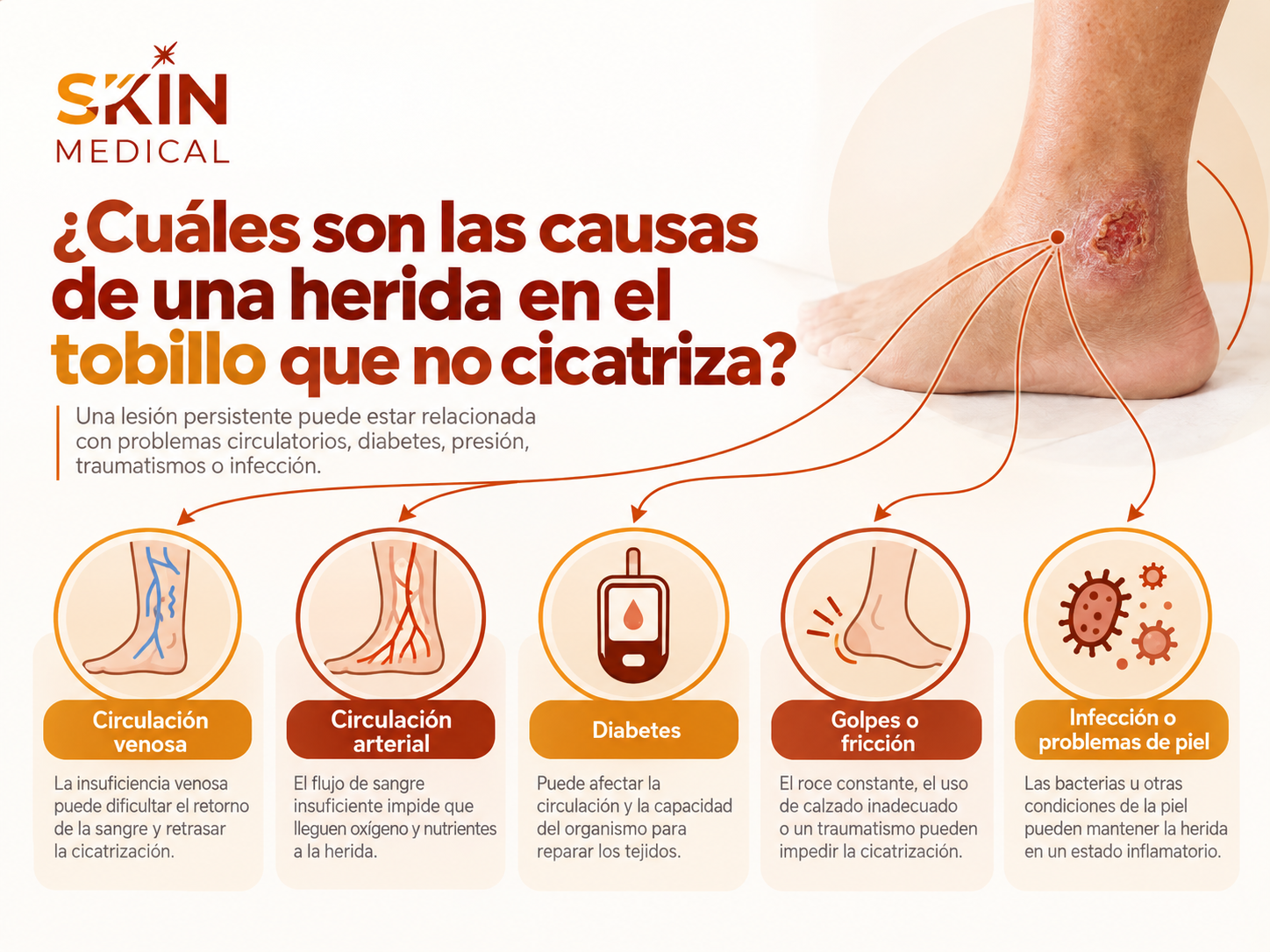 ¿Cuáles son las causas de una herida en el tobillo que no cicatriza?