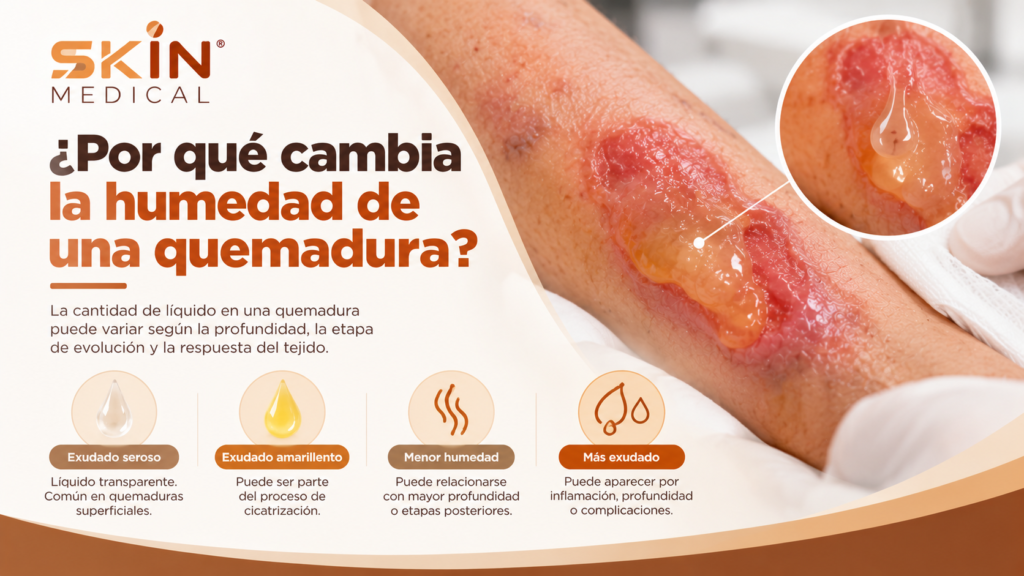 ¿Por qué cambia la humedad de una quemadura?