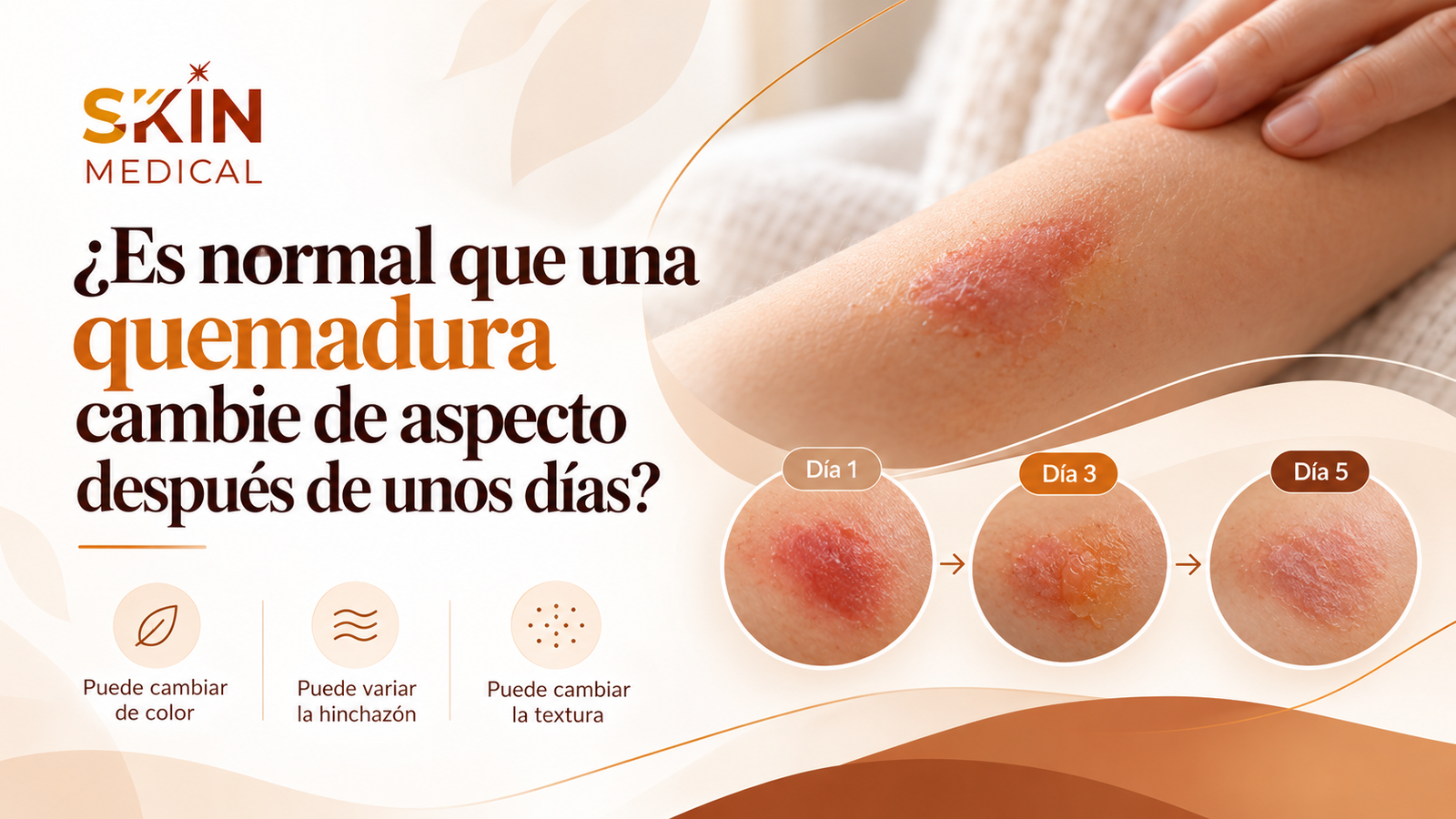 ¿Es normal que una quemadura cambie de aspecto después de unos días?