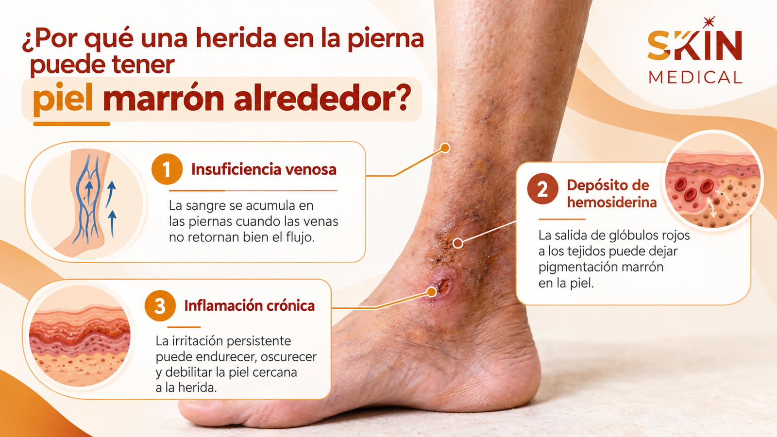 ¿Por qué una herida en la pierna puede tener piel marrón alrededor?