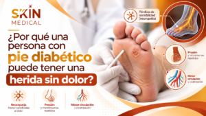¿Por qué una persona con pie diabético puede tener una herida sin dolor?