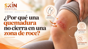 ¿Por qué una quemadura no cierra en una zona de roce?
