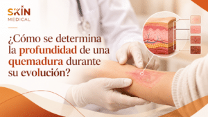 ¿Cómo se determina la profundidad de una quemadura durante su evolución?