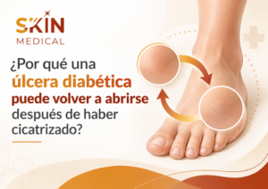 ¿Por qué una úlcera diabética puede volver a abrirse después de haber cicatrizado?