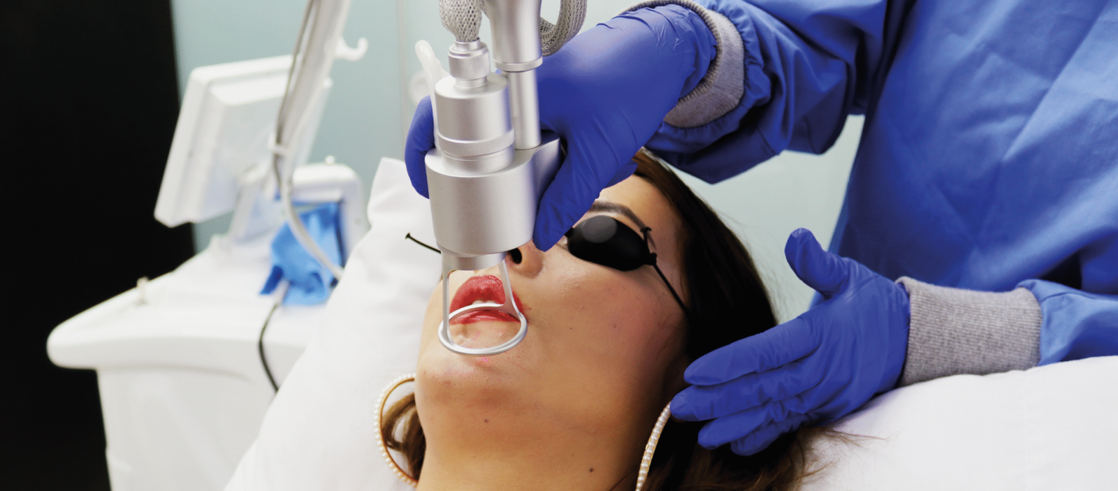 Paciente recibiendo tratamiento láser facial en los labios para eliminar cicatrices.