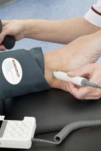 Skindoplex para Pie Diabético: Cómo Ayuda en la Recuperación