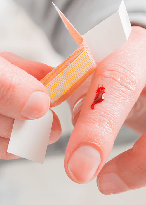 Cómo quitar o curar heridas y cortes en la piel