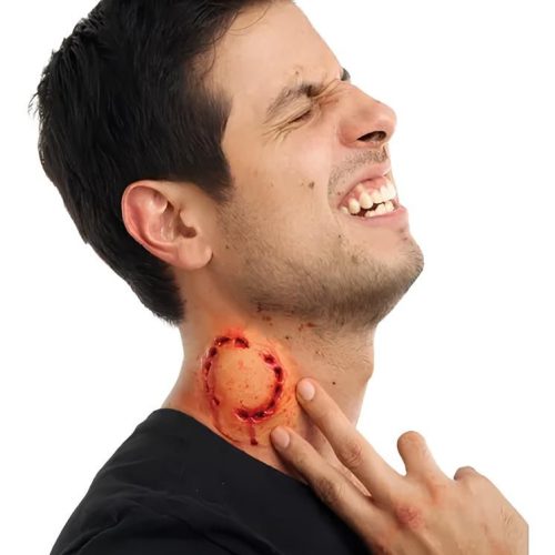 mordedura humana tratamiento mordedura humana tratamiento