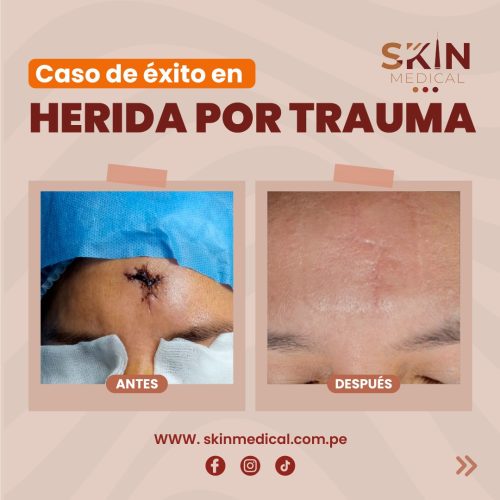 tratamiento de heridas